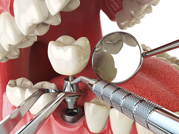 Best Urgent Tooth Repair  in Orland Park, IL